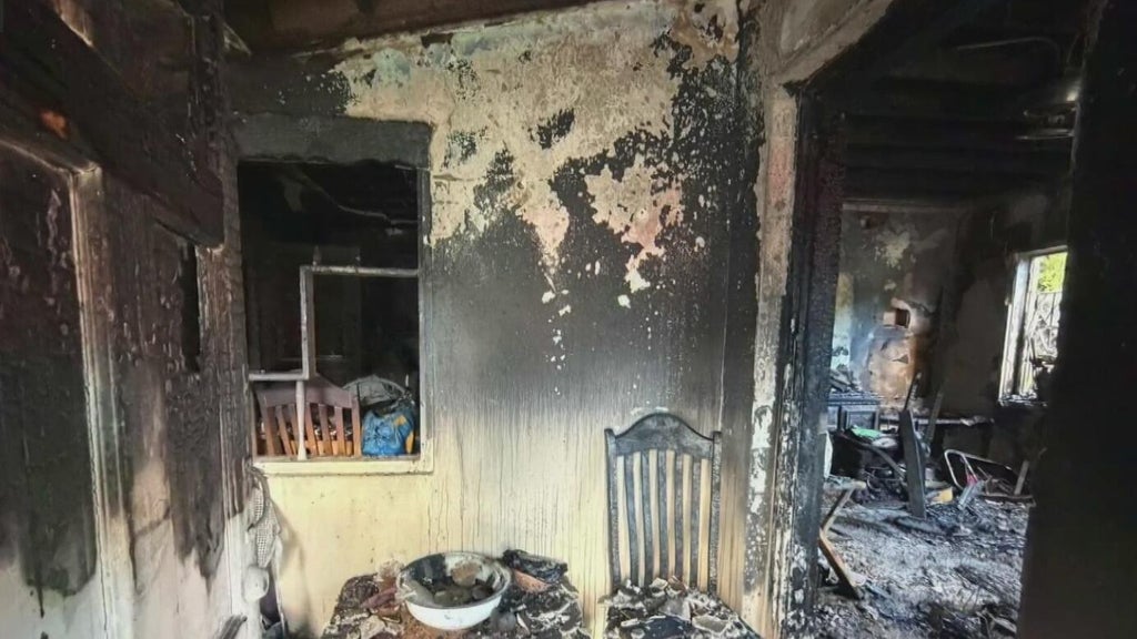 Woman hospitalized after Miami house fire leaves three displaced — CBS Miami, Key Biscayne Health news