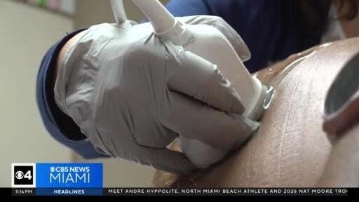 Birth rate for women over the age of 35, or mature pregnancies, is rising — CBS Miami, Key Biscayne Health news