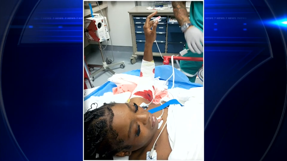 17-year-old speaks out while recovering from serious injuries in pit bull attack in NW Miami-Dade — WSVN 7 Miami-Dade, Key Biscayne Health news